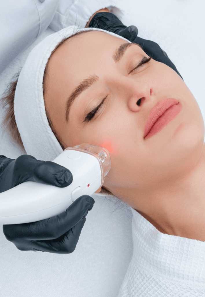 Laser Skin Resurfacing