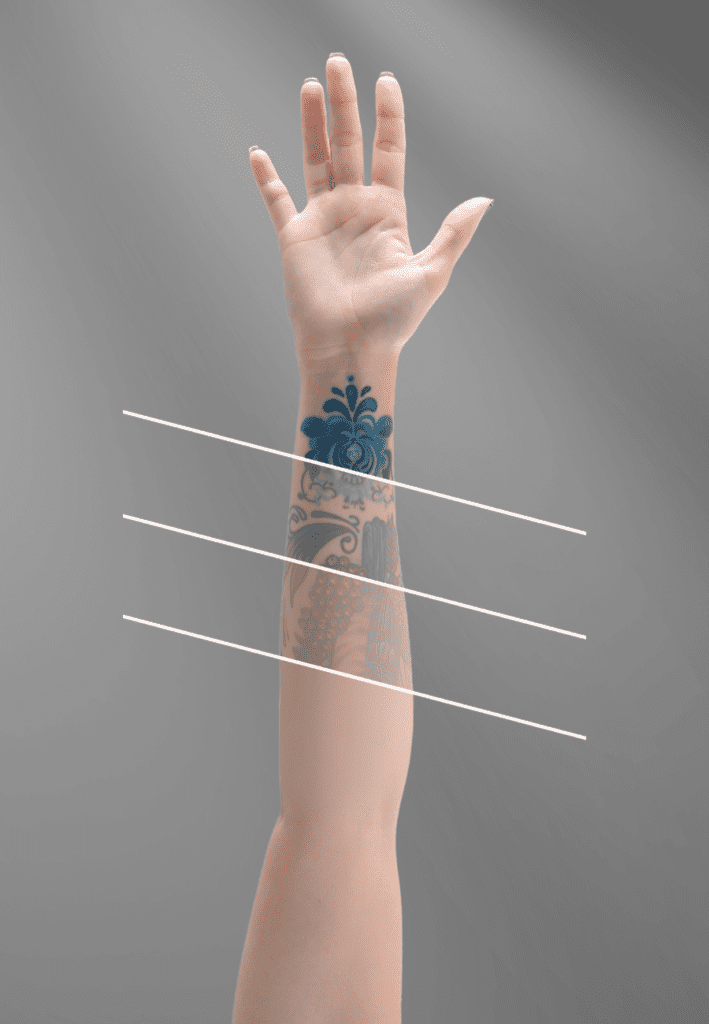 View of a womans arm with stages of her tattoo fading after Spectrum Tattoo Removal