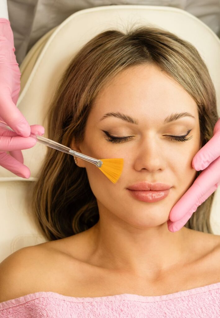 Woman receiving chemical peel treatment to help exfoliate and remove dead skin cells revealing smoother fresher skin