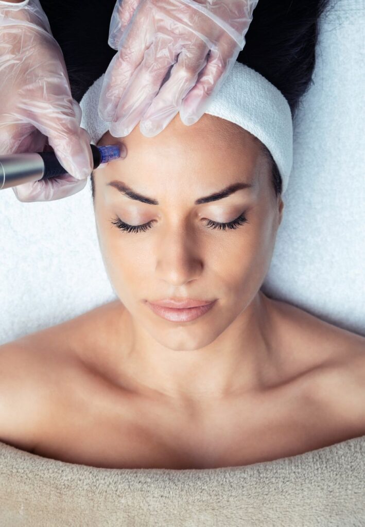 Close up of a woman receiving microneedling