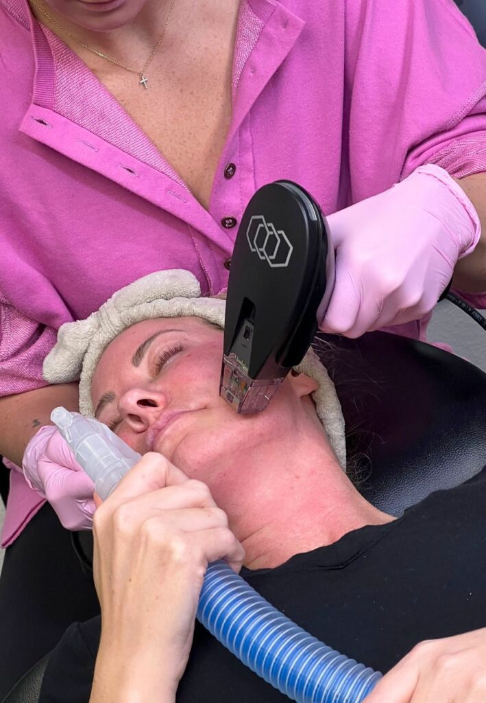 Woman receiving morpheus treatment to help her skin become smoother, tighter, and more youthful-looking